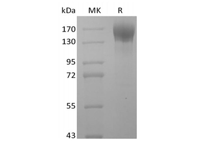 Recombinant Human LEPR (C-Fc)