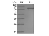 Recombinant Human Notch2 (C-6His)