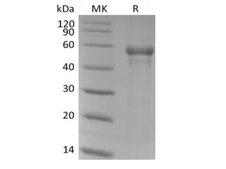 Recombinant Human B3GAT1 (N-6His)