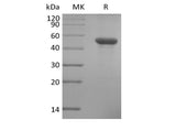 Recombinant Human ILDR2 (C-6His)