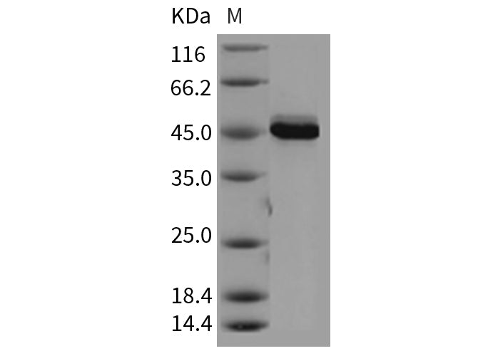Recombinant Mouse AKT3 Protein (aa 106-479)(Active)