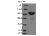 Recombinant Mouse CRELD1 Protein (His Tag)