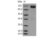 Recombinant Mouse CDCP1/CD318 Protein (His Tag)
