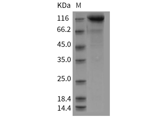 Recombinant Mouse CDCP1/CD318 Protein (Fc Tag)