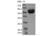 Recombinant Mouse OBCAM/OPCML Protein (aa 5-313, His Tag)(Active)