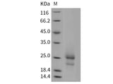 Recombinant Mouse TSLP Protein (His Tag)(Active)