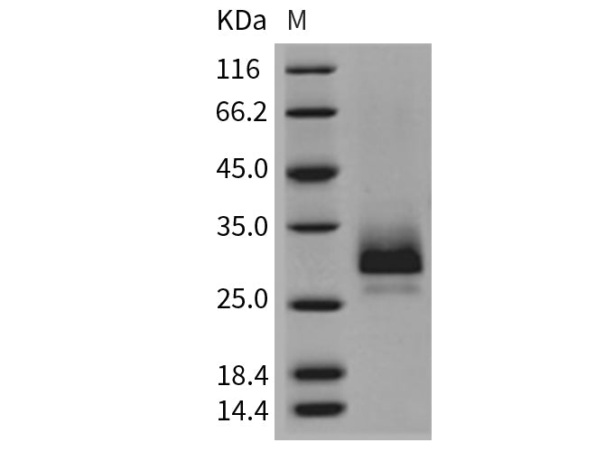 Recombinant Mouse TFPI2 Protein (His Tag)
