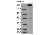 Recombinant Mouse VEGFR2/Flk-1/KDR Protein (Fc Tag)(Active)