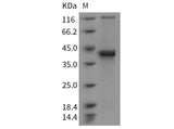 Recombinant Mouse S100B Protein (Fc Tag)(Active)