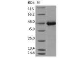 Recombinant Mouse Wnt Inhibitory Factor 1/WIF1 Protein (His Tag)