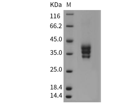 Recombinant Mouse ESAM Protein (His Tag)