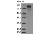 Recombinant Mouse Semaphorin 5A/SEMA5A Protein (His Tag)