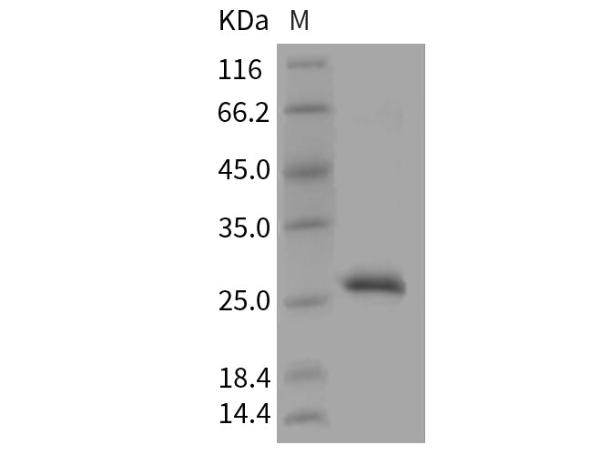 Recombinant Mouse RPE/RPE2-1 Protein (His Tag)