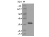 Recombinant Mouse RPE/RPE2-1 Protein (His Tag)