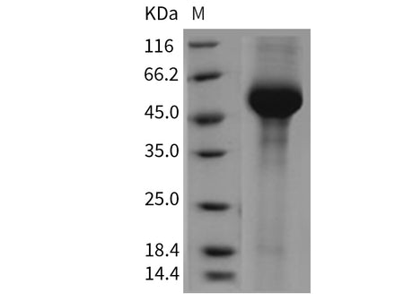 Recombinant Mouse alpha-Galactosidase A/GLA Protein (His Tag)(Active)