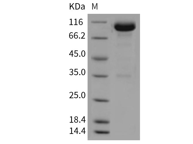 Recombinant Mouse OBCAM/OPCML Protein (Fc Tag)(Active)