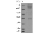 Recombinant Mouse CD172a/SIRPA Protein (Fc Tag)(Active)