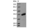 Recombinant Mouse SPINK4 Protein (Fc Tag)