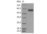 Recombinant Mouse VNN1/Vanin-1 Protein (His Tag)