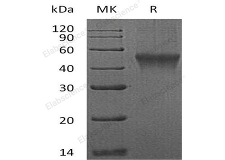 Recombinant Mouse FCRL1 Protein (aa 1-204, His Tag)