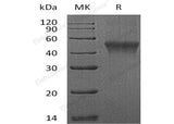 Recombinant Mouse FCRL1 Protein (aa 1-204, His Tag)