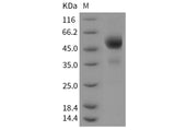 Recombinant Mouse TIGIT Protein (Fc Tag)(Active)