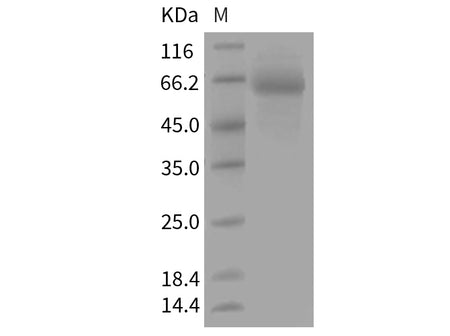 Recombinant Mouse FcERI/FCER1A Protein (Fc Tag)