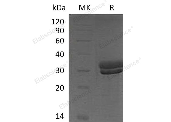Recombinant Mouse Kallikrein 7/KLK7 Protein (His Tag)(Active)