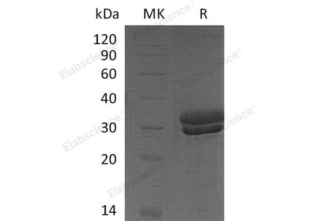 Recombinant Mouse Kallikrein 7/KLK7 Protein (His Tag)(Active)