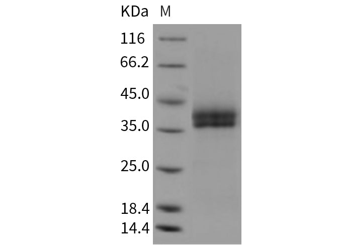 Recombinant Mouse Kallikrein 11/KLK11 Protein (His Tag)