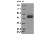 Recombinant Mouse Kallikrein 11/KLK11 Protein (His Tag)