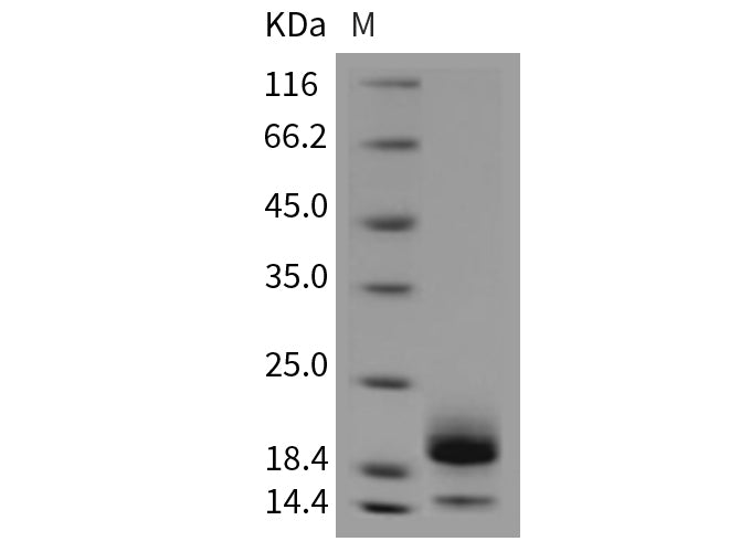 Recombinant Mouse Cystatin E/CST6 Protein (His Tag)(Active)