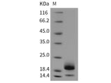 Recombinant Mouse Cystatin E/CST6 Protein (His Tag)(Active)