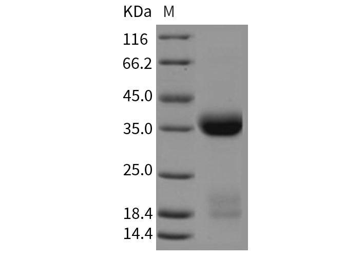 Recombinant Mouse Kallikrein 1/KLK1 Protein (His Tag)(Active)