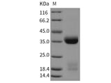 Recombinant Mouse Kallikrein 1/KLK1 Protein (His Tag)(Active)
