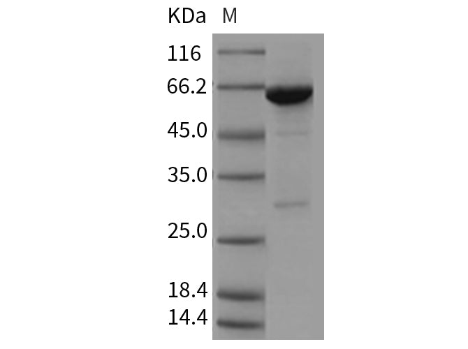 Recombinant Mouse PTPN6/SH-PTP1 Protein (aa 207-597, His & GST Tag)(Active)