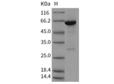 Recombinant Mouse PTPN6/SH-PTP1 Protein (aa 207-597, His & GST Tag)(Active)