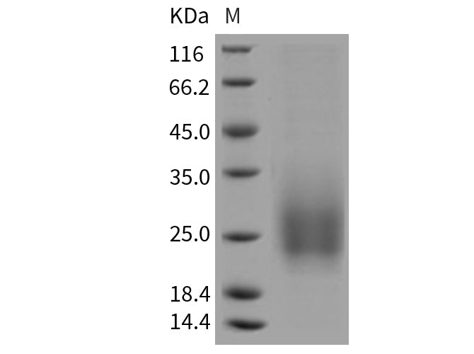 Recombinant Mouse TALLA-1/TSPAN7 Protein (His Tag)