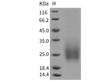 Recombinant Mouse TALLA-1/TSPAN7 Protein (His Tag)