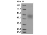 Recombinant Mouse EPCR Protein (His Tag)