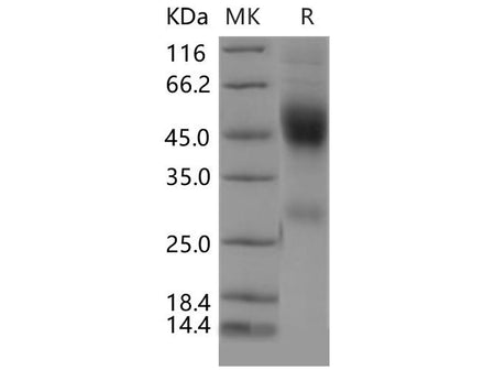 Recombinant Mouse Neurexophilin-1/NXPH1 Protein (His Tag)