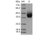 Recombinant Mouse IL10RB/IL10R2 Protein (His Tag)(Active)