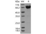 Recombinant Mouse IL10RB/IL10R2 Protein (Fc Tag)