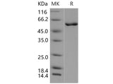 Recombinant Mouse CAMK4/CaMKIV Protein (Active)