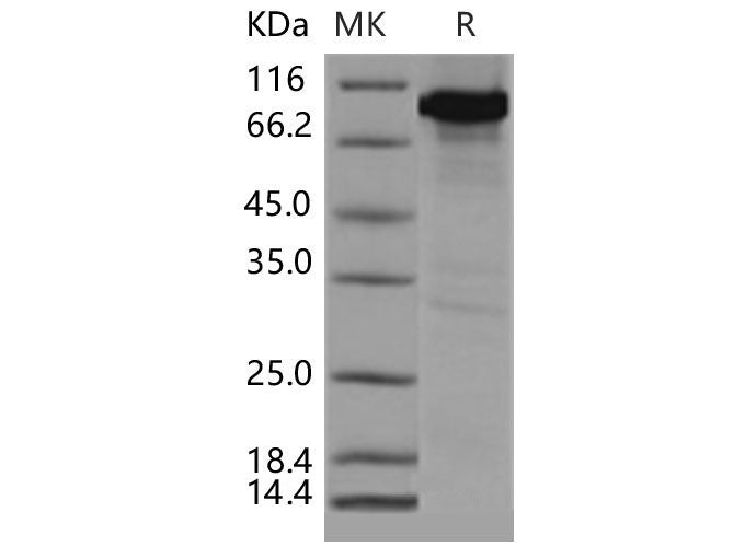 Recombinant Mouse CAMK4/CaMKIV Protein (His & GST Tag)