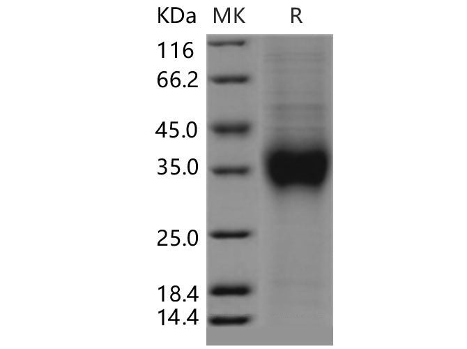 Recombinant Mouse CD159a/KLRC1 Protein (His Tag)