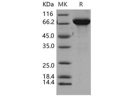 Recombinant Mouse THOP1 Protein (His Tag)(Active)