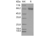 Recombinant Mouse EphA1 Protein (His Tag)(Active)