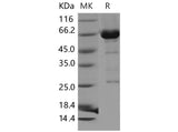 Recombinant Mouse CDC37/CDC37A Protein (His & GST Tag)