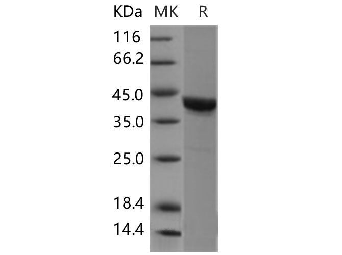 Recombinant Mouse CSNK2A1/CK2A1 Protein (Active)